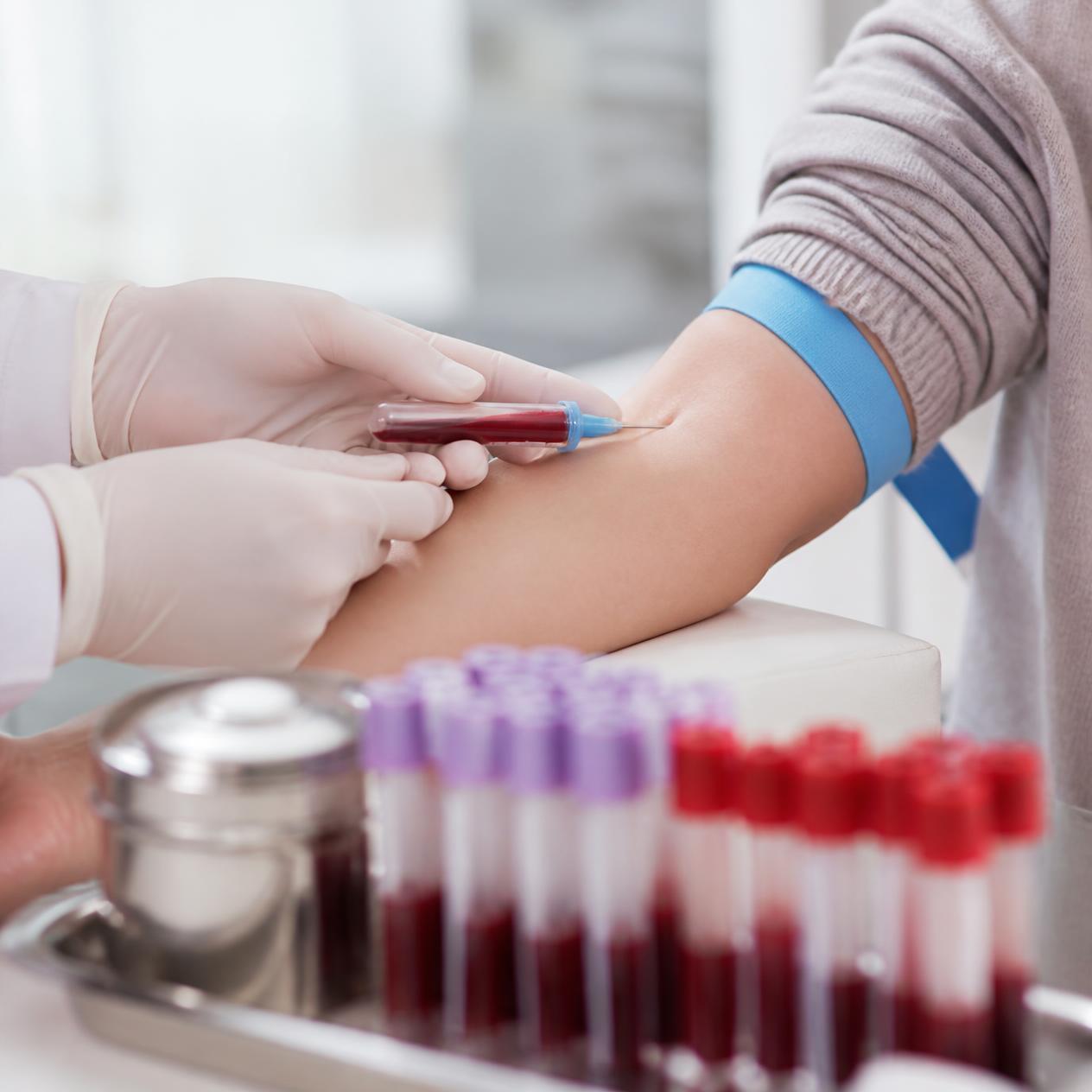 Pobranie krwi do badań hormonalnych z probówkami laboratoryjnymi